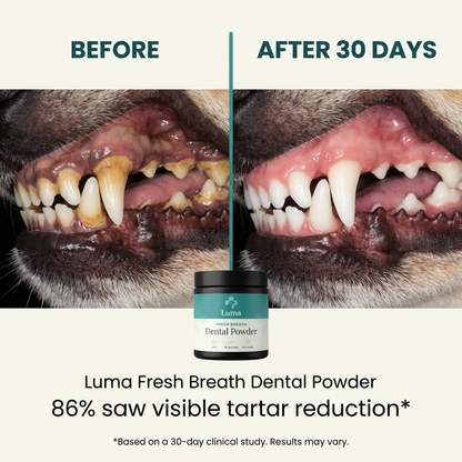 Luma™ Dental Powder