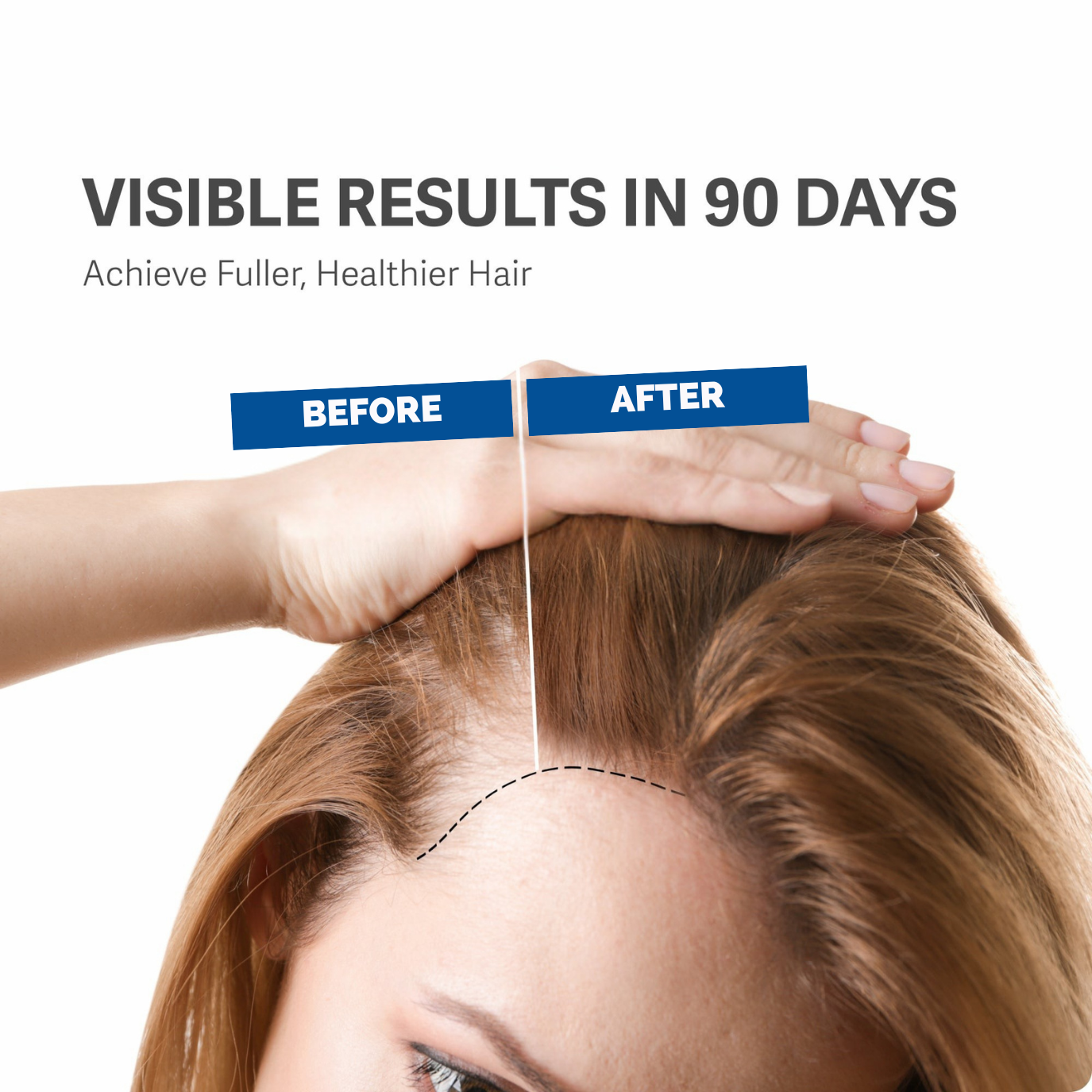 Hair Vitamine Gummies